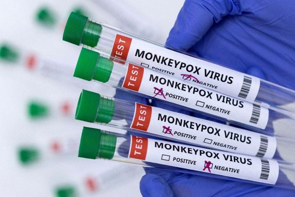 Caetité registra primeiro caso suspeito de varíola dos macacos