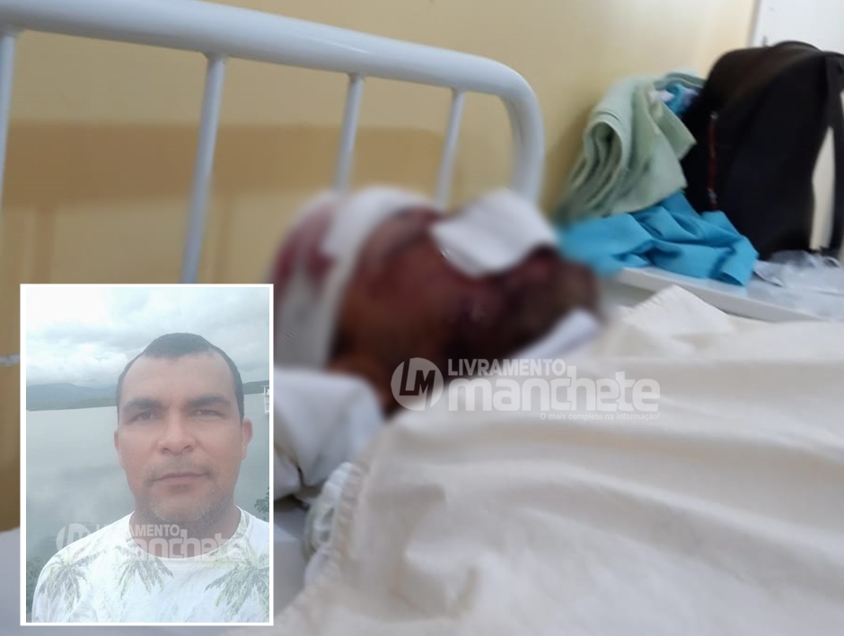 Homem fica gravemente ferido após sofrer acidente, vítima está internada no hospital municipal de Livramento